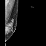 case 1 a